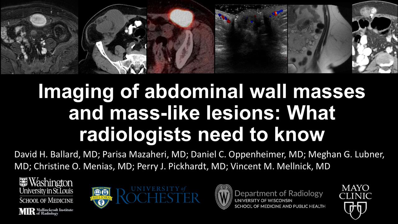 Imaging Of Abdominal Wall Masses And Mass Like Lesions What