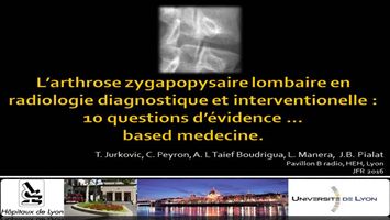 OA-WP-05 - L'arthrose zygapophysaire lombaire : une question d ...