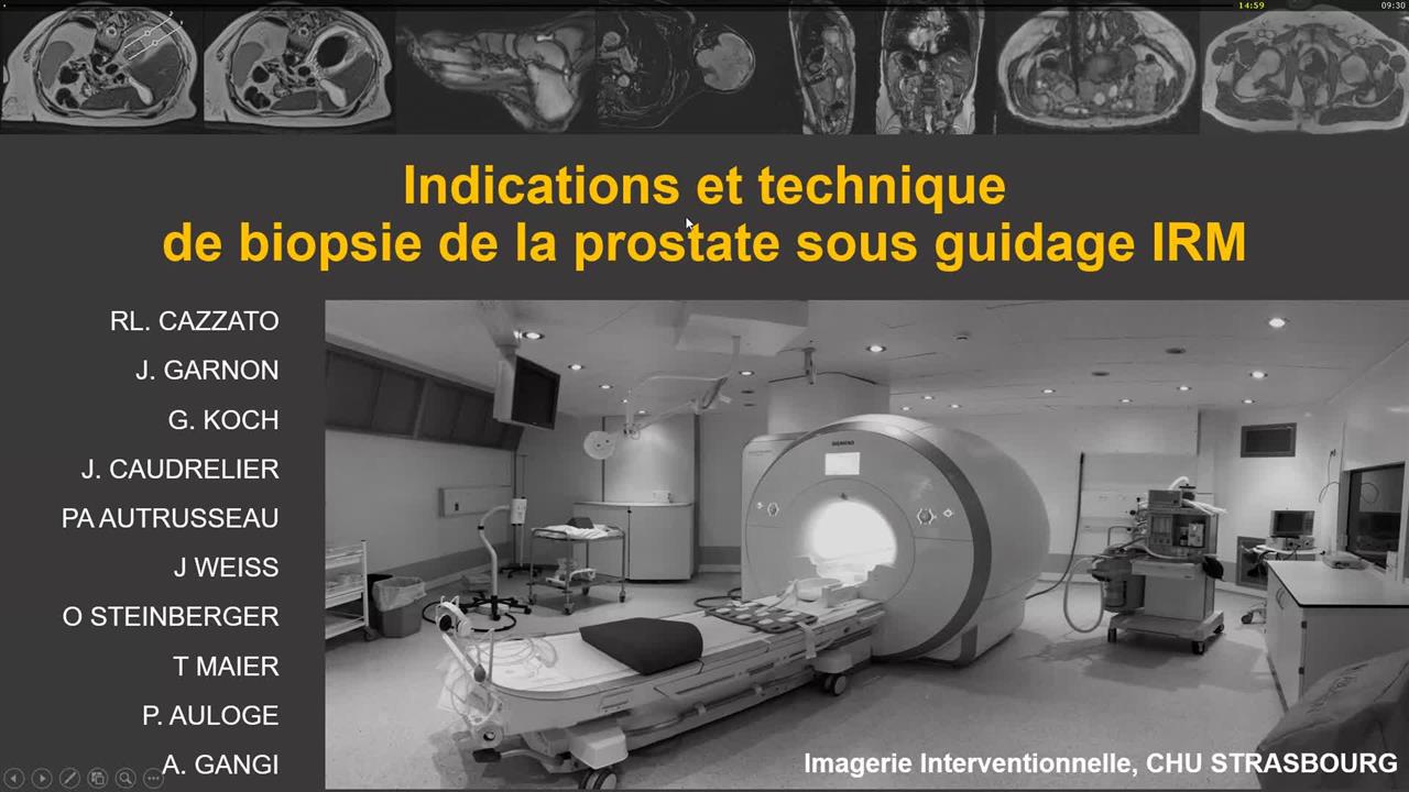 Indications Et Technique De Biopsie Sous Guidage Irm