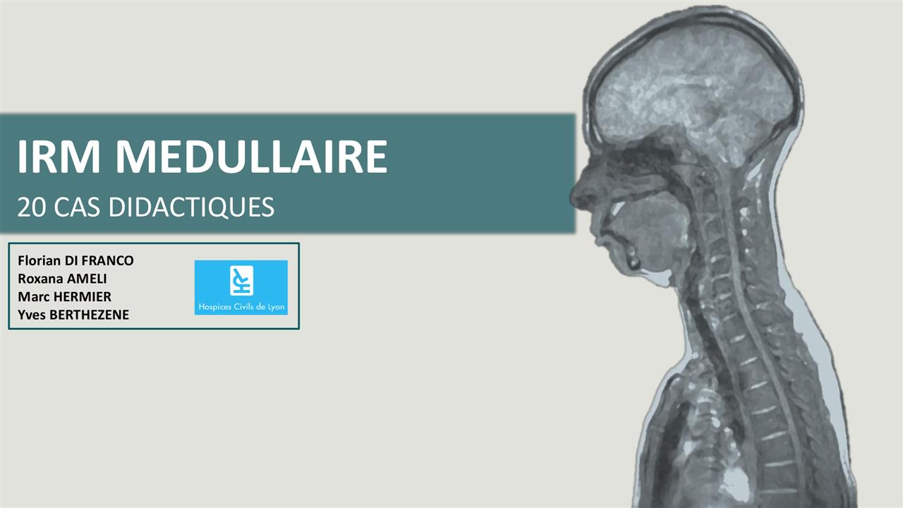 IRM MEDULLAIRE : 20 cas didactiques